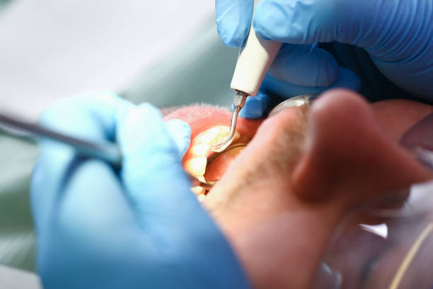Best Pediatric Emergency Dentist in Hudson, NC